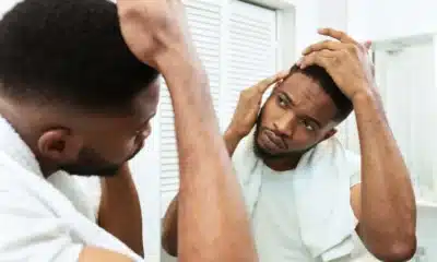 queda, de cabelo, calvície, fios, cabelos;