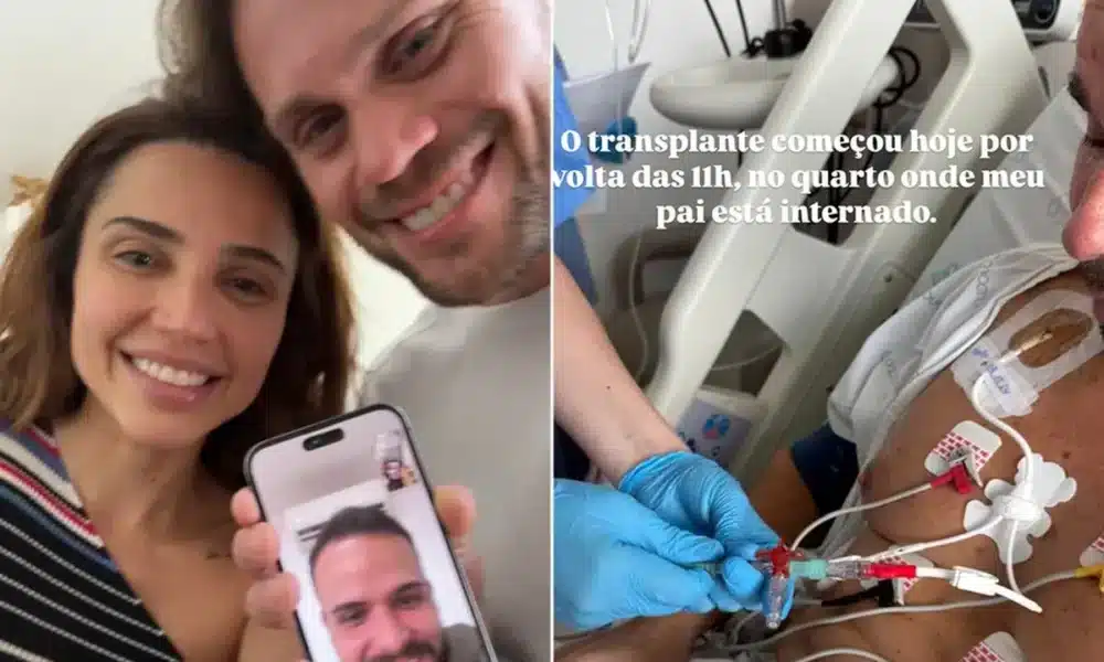 raro, transplante, de medula, medula, óssea